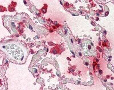 Immunohistochemistry-Paraffin: Tryptase alpha/TPS1 Antibody (AA1) [NBP1-40202] -  Analysis of anti-TPSAB1 / Mast Cell Tryptase antibody with human lung at concentration 5 ug/ml.