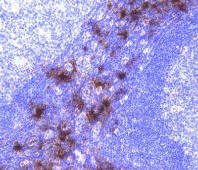 Immunohistochemistry-Paraffin: Tryptase alpha/TPS1 Antibody (SC68-07) [NBP2-67608] - Human tonsil tissue using anti-Mast Cell Tryptase antibody. The section was pre-treated using heat mediated antigen retrieval with Tris-EDTA buffer (pH 8.0-8.4) for 20 minutes.The tissues were blocked in 5% BSA for 30 minutes at room temperature, washed with ddH2O and PBS, and then probed with the primary antibody (1/200) for 30 minutes at room temperature. The detection was performed using an HRP conjugated compact polymer system. DAB was used as the chromogen. Tissues were counterstained with hematoxylin and mounted with DPX.