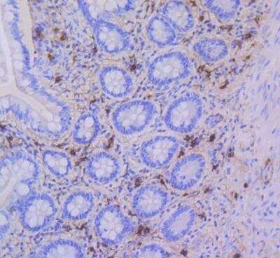 Immunohistochemistry-Paraffin: Tryptase alpha/TPS1 Antibody (SC68-07) [NBP2-67608] - Human small intestine tissue using anti-Mast Cell Tryptase antibody. The section was pre-treated using heat mediated antigen retrieval with Tris-EDTA buffer (pH 8.0-8.4) for 20 minutes.The tissues were blocked in 5% BSA for 30 minutes at room temperature, washed with ddH2O and PBS, and then probed with the primary antibody (1/200) for 30 minutes at room temperature. The detection was performed using an HRP conjugated compact polymer system. DAB was used as the chromogen. Tissues were counterstained with hematoxylin and mounted with DPX.