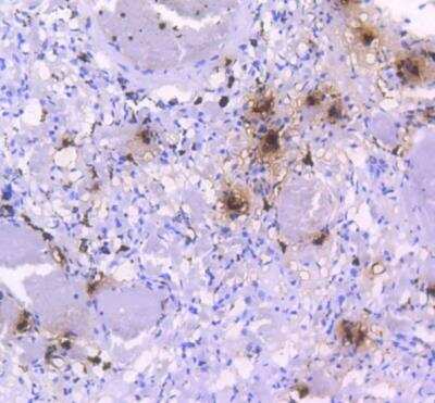 Immunohistochemistry-Paraffin: Tryptase alpha/TPS1 Antibody (SC68-07) [NBP2-67608] - Human lung tissue using anti-Mast Cell Tryptase antibody. The section was pre-treated using heat mediated antigen retrieval with Tris-EDTA buffer (pH 8.0-8.4) for 20 minutes.The tissues were blocked in 5% BSA for 30 minutes at room temperature, washed with ddH2O and PBS, and then probed with the primary antibody (1/50) for 30 minutes at room temperature. The detection was performed using an HRP conjugated compact polymer system. DAB was used as the chromogen. Tissues were counterstained with hematoxylin and mounted with DPX.