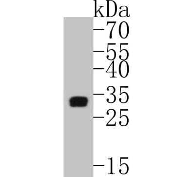 Western Blot: Tryptase alpha/TPS1 Antibody (SC68-07) [NBP2-67608] - Human skin tissue lysates. Proteins were transferred to a PVDF membrane and blocked with 5% BSA in PBS for 1 hour at room temperature. The primary antibody ( 1/500) was used in 5% BSA at room temperature for 2 hours. Goat Anti-Rabbit IgG - HRP Secondary Antibody at 1:5,000 dilution was used for 1 hour at room temperature.