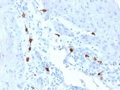 Immunohistochemistry-Paraffin: Tryptase alpha/TPS1 Antibody (TPSAB1/1963) - Azide and BSA Free [NBP3-08649] - Formalin-fixed, paraffin-embedded human Skin stained with Tryptase alpha/TPS1 Mouse Monoclonal Antibody (TPSAB1/1963).