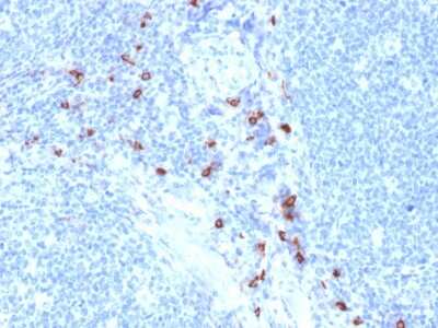 Immunohistochemistry-Paraffin: Tryptase alpha/TPS1 Antibody (TPSAB1/1963) - Azide and BSA Free [NBP3-08649] - Formalin-fixed, paraffin-embedded human Tonsil stained with Tryptase alpha/TPS1 Mouse Monoclonal Antibody (TPSAB1/1963).