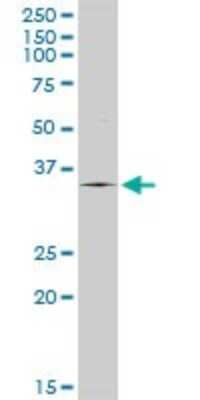 Western Blot: Tryptase alpha/TPS1 Antibody [H00007177-D01P] - Analysis of TPSAB1 expression in human colon.