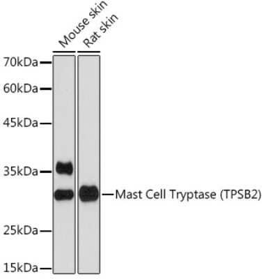 Western Blot Tryptase beta-2/TPSB2 Antibody (6U1C5)