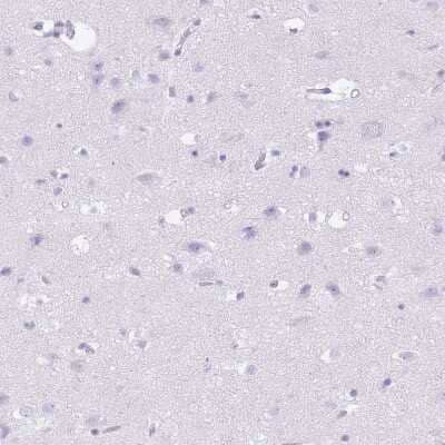 Immunohistochemistry-Paraffin: Tryptase beta-2/TPSB2 Antibody [NBP2-33551] - Staining of human cerebral cortex shows no positivity in neurons as expected.