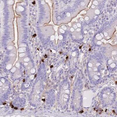 Immunohistochemistry-Paraffin: Tryptase beta-2/TPSB2 Antibody [NBP2-33551] - Staining of human gastrointestinal shows strong cytoplasmic positivity in lymphoid cells.