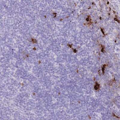 Immunohistochemistry-Paraffin: Tryptase beta-2/TPSB2 Antibody [NBP2-33551] - Staining of human lymphoid tissues shows strong cytoplasmic positivity in non-germinal center cells.