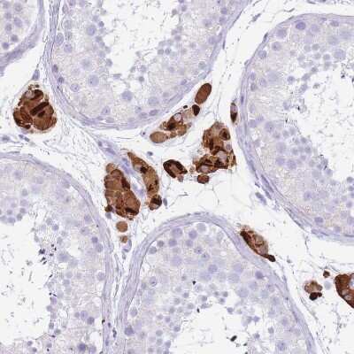 Immunohistochemistry-Paraffin: Tryptase beta-2/TPSB2 Antibody [NBP2-33551] - Staining of human testis shows strong cytoplasmic positivity in Leydig cells.