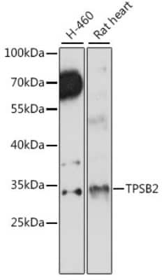 Western Blot: Tryptase beta-2/TPSB2 Antibody [NBP3-05583] - Western blot analysis of extracts of various cell lines, using Mast Cell Tryptase (Tryptase beta-2/TPSB2) antibody (NBP3-05583) at 1:1000 dilution. Secondary antibody: HRP Goat Anti-Rabbit IgG (H+L) at 1:10000 dilution. Lysates/proteins: 25ug per lane. Blocking buffer: 3% nonfat dry milk in TBST. Detection: ECL Basic Kit. Exposure time: 90s.