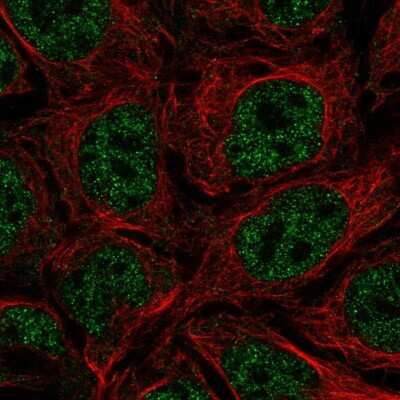 Immunocytochemistry/Immunofluorescence: Tryptase epsilon/BSSP-4/PRSS22 Antibody [NBP2-13817] - Staining of human cell line CACO-2 shows localization to nucleoplasm.