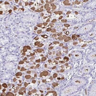 Immunohistochemistry: Tryptase gamma-1/TPSG1 Antibody [NBP2-37977] - Staining of human stomach, lower shows strong cytoplasmic positivity in parietal cells.