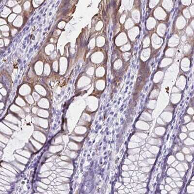 Immunohistochemistry-Paraffin: Tryptase gamma-1/TPSG1 Antibody [NBP2-37977] - Staining of human colon shows high expression.