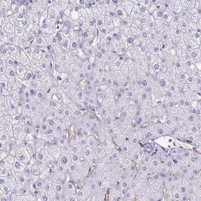 Immunohistochemistry-Paraffin: Tryptase gamma-1/TPSG1 Antibody [NBP2-37977] - Staining of human liver shows low expression as expected.