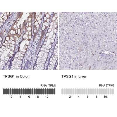 <b>Orthogonal Strategies Validation. </b>Immunohistochemistry-Paraffin: Tryptase gamma-1/TPSG1 Antibody [NBP2-37977] - Staining in human colon and liver tissues using anti-TPSG1 antibody. Corresponding TPSG1 RNA-seq data are presented for the same tissues.