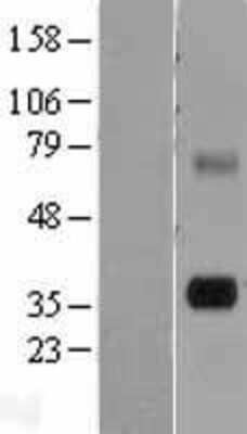 Western Blot: Tryptase gamma Overexpression Lysate (Adult Normal) [NBL1-17231] Left-Empty vector transfected control cell lysate (HEK293 cell lysate); Right -Over-expression Lysate for Tryptase gamma.