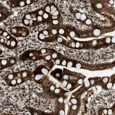 Immunohistochemistry-Paraffin Tryptophan rich protein Antibody