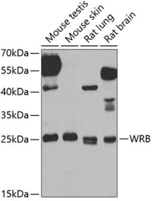 Western Blot: Tryptophan rich protein Antibody [NBP2-94520] - Analysis of extracts of various cell lines, using Tryptophan rich protein at 1:1000 dilution. Secondary antibody: HRP Goat Anti-Rabbit IgG (H+L) at 1:10000 dilution. Lysates/proteins: 25ug per lane. Blocking buffer: 3% nonfat dry milk in TBST. Detection: ECL Basic Kit . Exposure time: 90s.
