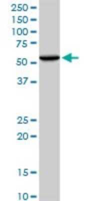 Western Blot: Tryptophanyl tRNA synthetase Antibody [H00007453-B01P] - Analysis of WARS expression in HepG2.