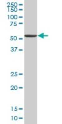 Western Blot: Tryptophanyl tRNA synthetase Antibody [H00007453-B01P] - Analysis of WARS expression in human spleen.