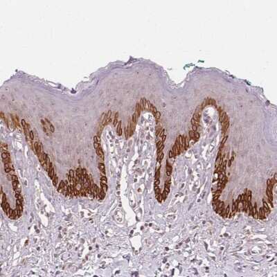 Immunohistochemistry: Tubby Antibody [NBP2-48924] - Staining of human skin shows strong cytoplasmic positivity in basal call layer of epidermis.