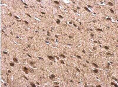 Immunohistochemistry-Paraffin: Tubby Antibody [NBP2-20758] - Rat fore brain. Tub antibody dilution: 1:500. Antigen Retrieval: Trilogy™ (EDTA based, pH 8.0) buffer, 15min. 