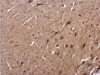 Immunohistochemistry-Paraffin: Tubby Antibody [NBP2-20758] - Mouse fore brain. Tub antibody dilution: 1:500. Antigen Retrieval: Trilogy™ (EDTA based, pH 8.0) buffer, 15min. 