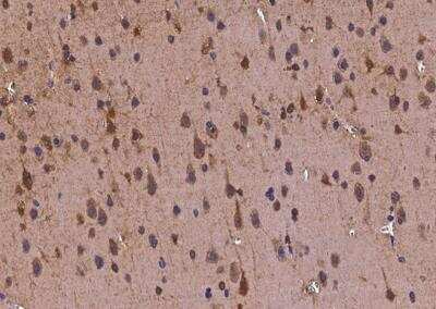 Immunohistochemistry-Paraffin: Tubby Antibody [NBP2-97149] - Staining of human TUB in human brain with rabbit polyclonal antibody at 1:300 dilution.