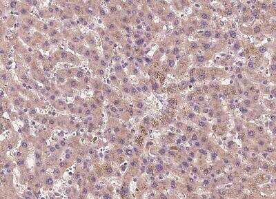 Immunohistochemistry-Paraffin: Tubby Antibody [NBP2-97149] - Staining of human TUB in human liver with rabbit polyclonal antibody at 1:300 dilution.