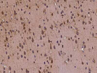 Immunohistochemistry-Paraffin: Tubby Antibody [NBP2-97149] - Immunochemical staining of human Tubby in human brain with rabbit polyclonal antibody at 1:300 dilution, formalin-fixed paraffin embedded sections.