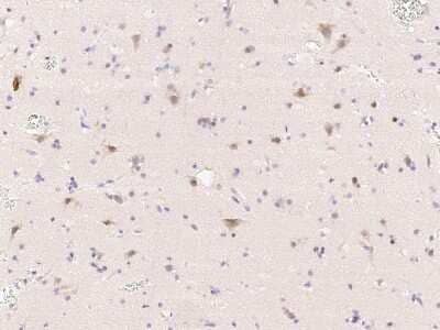 Immunohistochemistry-Paraffin: Tubby Antibody [NBP2-99110] - Immunochemical staining of human Tubby in human brain with rabbit polyclonal antibody (1:1000, formalin-fixed paraffin embedded sections).