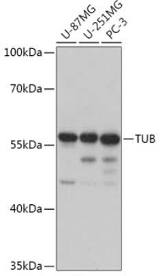 Western Blot: Tubby Antibody [NBP2-93966] - Analysis of extracts of various cell lines, using Tubby at 1:1000 dilution. Secondary antibody: HRP Goat Anti-Rabbit IgG (H+L) at 1:10000 dilution. Lysates/proteins: 25ug per lane. Blocking buffer: 3% nonfat dry milk in TBST. Detection: ECL Basic Kit . Exposure time: 1s.