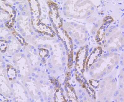 Immunohistochemistry-Paraffin: Tubulin Beta 2C Antibody (ST52-04) [NBP2-67520] - Analysis of paraffin-embedded human kidney tissue using anti-beta II Tubulin antibody. Counter stained with hematoxylin.