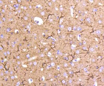 Immunohistochemistry-Paraffin: Tubulin Beta 2C Antibody (ST52-04) [NBP2-67520] - Analysis of paraffin-embedded mouse brain tissue using anti-beta II Tubulin antibody. Counter stained with hematoxylin.