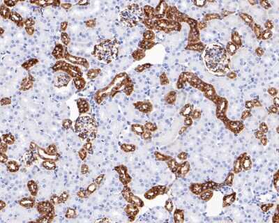 Immunohistochemistry-Paraffin: Tubulin Beta 2C Antibody (ST52-04) [NBP2-67520] - Immunohistochemical analysis of paraffin-embedded mouse kidney tissue using anti-Tubulin Beta 2C antibody. The section was pre-treated using heat mediated antigen retrieval with Tris-EDTA buffer (pH 8.0-8.4) for 20 minutes. The tissues were blocked in 5% BSA for 30 minutes at room temperature, washed with ddH2O and PBS, and then probed with the primary antibody (ET1609-48, 1/50) for 30 minutes at room temperature. The detection was performed using an HRP conjugated compact polymer system. DAB was used as the chromogen. Tissues were counterstained with hematoxylin and mounted with DPX.