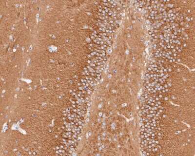 Immunohistochemistry-Paraffin: Tubulin Beta 2C Antibody (ST52-04) [NBP2-67520] - Immunohistochemical analysis of paraffin-embedded rat brain tissue using anti-Tubulin Beta 2C antibody. The section was pre-treated using heat mediated antigen retrieval with Tris-EDTA buffer (pH 8.0-8.4) for 20 minutes. The tissues were blocked in 5% BSA for 30 minutes at room temperature, washed with ddH2O and PBS, and then probed with the primary antibody (ET1609-48, 1/50) for 30 minutes at room temperature. The detection was performed using an HRP conjugated compact polymer system. DAB was used as the chromogen. Tissues were counterstained with hematoxylin and mounted with DPX.