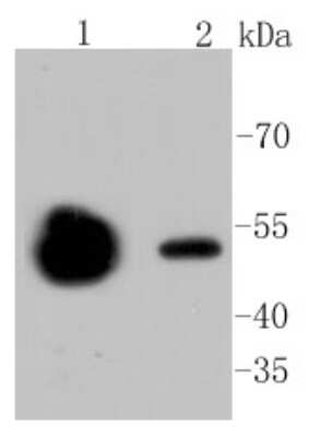 Western Blot: Tubulin Beta 2C Antibody (ST52-04) [NBP2-67520] - Analysis of beta II Tubulin on different lysates using anti-beta II Tubulin antibody at 1/1,000 dilution. Positive control: Lane 1: Mouse brain Lane 2: Mouse kidney