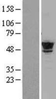 Western Blot: Tubulin Beta 2C Overexpression Lysate (Adult Normal) [NBL1-17439] Left-Empty vector transfected control cell lysate (HEK293 cell lysate); Right -Over-expression Lysate for Tubulin Beta 2C.