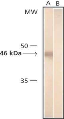 Western Blot: Tubulin Beta 3 Antibody (SDL.3D10) [NB120-11314] - Produced in mouse