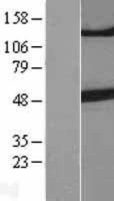 Western Blot beta-III Tubulin Overexpression Lysate