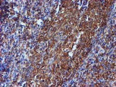 Immunohistochemistry: Tubulin Beta 4 Antibody (OTI3F1) - Azide and BSA Free [NBP2-74713] - Staining of paraffin-embedded Human tonsil using anti-Tubulin Beta 4 mouse monoclonal antibody.