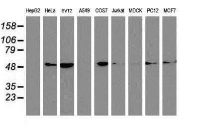 Western Blot: Tubulin Beta 4 Antibody (OTI3F1) - Azide and BSA Free [NBP2-74713] - Analysis of extracts (35ug) from 9 different cell lines by using anti-Tubulin Beta 4 monoclonal antibody.