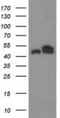 Western Blot: Tubulin Beta 4 Antibody (OTI3F1) - Azide and BSA Free [NBP2-74713] - HEK293T cells were transfected with the pCMV6-ENTRY control (Left lane) or pCMV6-ENTRY Tubulin Beta 4 (Right lane) cDNA for 48 hrs and lysed. Equivalent amounts of cell lysates (5 ug per lane) were separated by SDS-PAGE and immunoblotted with anti-Tubulin