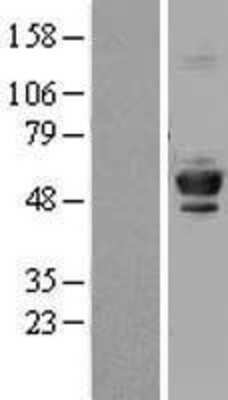 Western Blot: Tubulin Beta 4 Overexpression Lysate (Adult Normal) [NBL1-17441] Left-Empty vector transfected control cell lysate (HEK293 cell lysate); Right -Over-expression Lysate for Tubulin Beta 4.