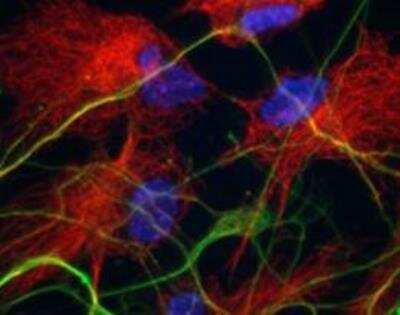 Immunohistochemistry: Tubulin Delta 2 Antibody [NB100-57397] - Analysis of human neuron.