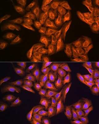 Immunocytochemistry/Immunofluorescence: Tubulin alpha-1B Antibody (8E8W9) [NBP3-16887] - Immunofluorescence analysis of U-2 OS cells using Tubulin alpha-1B Rabbit mAb (NBP3-16887) at dilution of 1:100 (40x lens). Blue: DAPI for nuclear staining.