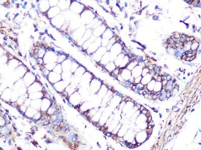 Immunohistochemistry-Paraffin: Tubulin alpha-1B Antibody (8E8W9) [NBP3-16887] - Immunohistochemistry of paraffin-embedded human colon using Tubulin alpha-1B Rabbit mAb (NBP3-16887) at dilution of 1:100 (40x lens).Perform microwave antigen retrieval with 10 mM Tris/EDTA buffer pH 9.0 before commencing with IHC staining protocol.