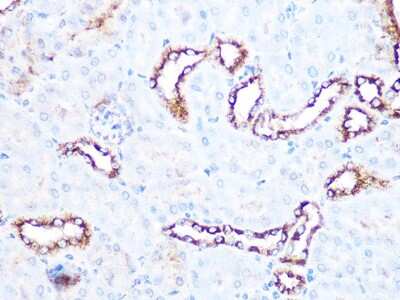 Immunohistochemistry-Paraffin: Tubulin alpha-1B Antibody (8E8W9) [NBP3-16887] - Immunohistochemistry of paraffin-embedded mouse kidney using Tubulin alpha-1B Rabbit mAb (NBP3-16887) at dilution of 1:100 (40x lens).Perform microwave antigen retrieval with 10 mM Tris/EDTA buffer pH 9.0 before commencing with IHC staining protocol.