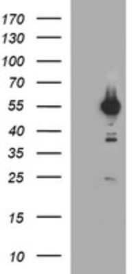 Western Blot: Tubulin alpha-1B Antibody (OTI3G3) - Azide and BSA Free [NBP2-74703] - Analysis of HEK293T cells were transfected with the pCMV6-ENTRY control (Left lane) or pCMV6-ENTRY  Tubulin alpha-1B.