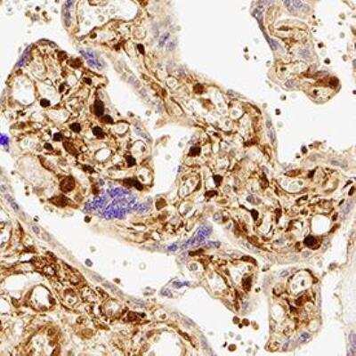 Immunohistochemistry: Tumor Growth Antibody Pack [NBP1-78956] - YAP1 was detected in immersion fixed paraffin-embedded sections of human placenta using Rabbit Anti-Human YAP1 polyclonal Antibody (Catalog # NB110-58358) at 1:200 for 1 hour at room temperature followed by incubation with the Anti-Rabbit IgG VisUCyteTM HRP Polymer Antibody (Catalog # VC003). Tissue was stained using DAB (brown) and counterstained with hematoxylin (blue). Specific staining was localized to nuclear and cytoplasm in trophoblast cells. YAP1 Antibody [NB110-58358]